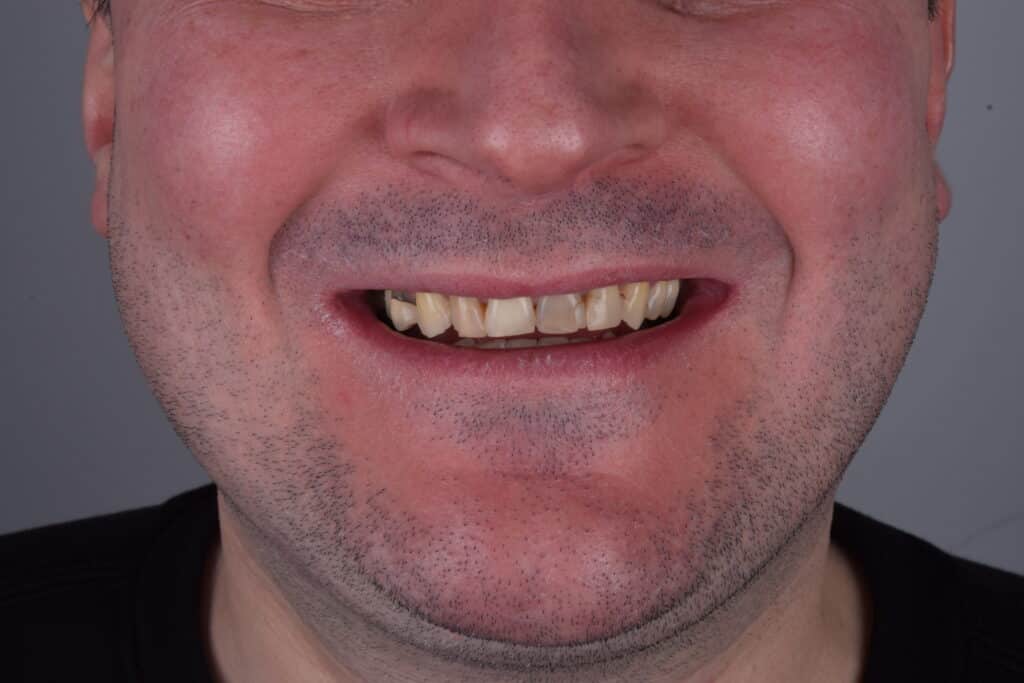 dentgroup before and after